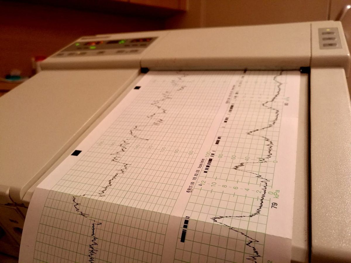 Grüne fürchten nach Bär-Äußerung um Datenschutz von Patienten - bei Kurznachrichten Plus